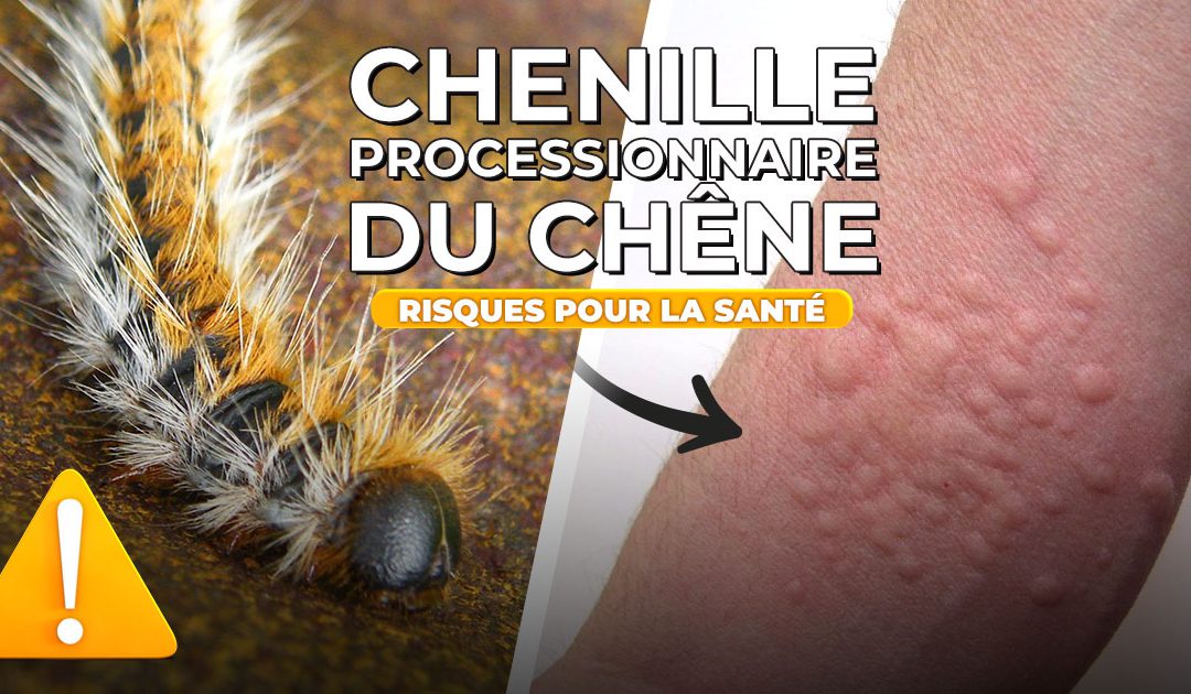 Chenille processionnaire du chêne – risques pour la santé